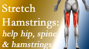 Chiropractic Spine Sports And Rehabilitation encourages back pain patients to stretch hamstrings for length, range of motion and flexibility to support the spine.