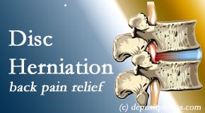 Chiropractic Spine Sports And Rehabilitation offers non-surgical treatment for relief of disc herniation related back pain. 