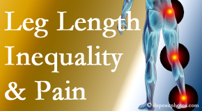 Chiropractic Spine Sports And Rehabilitation tests for leg length inequality as it is related to back, hip and knee pain issues.