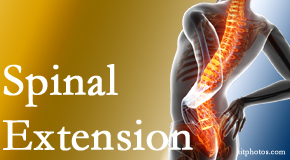 Chiropractic Spine Sports And Rehabilitation knows the role of extension in spinal motion, its necessity, its benefits and potential harmful effects. 