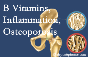 Tonawanda chiropractic care of osteoporosis usually comes with nutritional tips like b vitamins for inflammation reduction and for prevention.