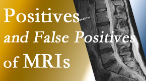 Chiropractic Spine Sports And Rehabilitation carefully decides when and if MRI images are needed to guide the Tonawanda chiropractic treatment plan. 