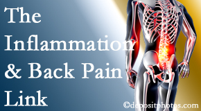 Chiropractic Spine Sports And Rehabilitation tackles the inflammatory process that accompanies back pain as well as the pain itself.