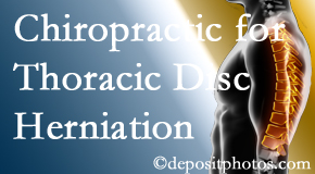 Chiropractic Spine Sports And Rehabilitation diagnoses and treats thoracic disc herniation pain and relieves its symptoms like unexplained abdominal pain or other gastrointestinal issues. 
