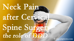 Chiropractic Spine Sports And Rehabilitation offers gentle treatment for neck pain after neck surgery.