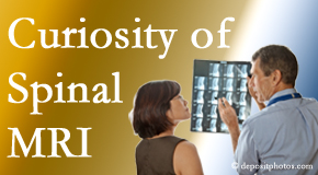 Tonawanda MRIs for spinal stenosis may be revealing…or puzzling.