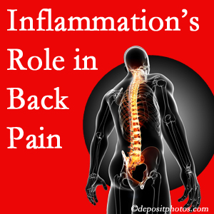 The role of inflammation in Tonawanda back pain is real. Chiropractic care can manage it.