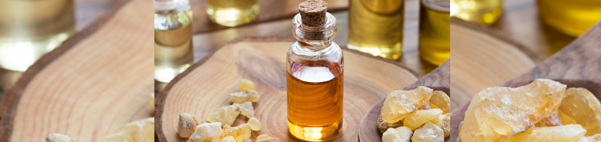 Tonawanda anti-inflammatory frankincense