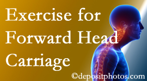 Tonawanda chiropractic treatment of forward head carriage is two-fold: manipulation and exercise.