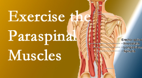 Chiropractic Spine Sports And Rehabilitation explains the importance of paraspinal muscles and their strength for Tonawanda back pain relief.