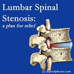 image of Tonawanda lumbar spinal stenosis 