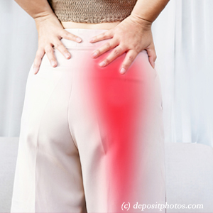 image of Tonawanda leg pain, sciatica, lumbar radiculopathy