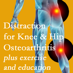 A chiropractic treatment plan for Tonawanda knee pain and hip pain due to osteoarthritis: education, exercise, distraction.