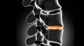 Tonawanda chiropractic nutrition with vitamin D and quercitrin