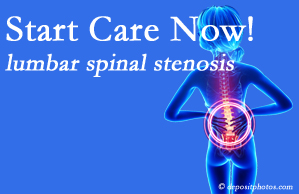 Chiropractic Spine Sports And Rehabilitation shares research that emphasizes that non-operative treatment for spinal stenosis within a month of diagnosis is beneficial. 