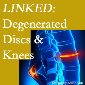 Degenerated discs and degenerated knees are not such strange bedfellows. They are seen to be related. Tonawanda patients with a loss of disc height due to disc degeneration often also have knee pain related to degeneration.  