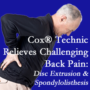 Tonawanda chiropractic care with Cox Technic alleviates back pain due to a painful combination of a disc extrusion and a spondylolytic spondylolisthesis.