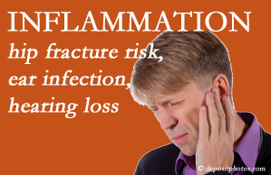 Chiropractic Spine Sports And Rehabilitation recognizes inflammation’s role in pain and presents how it may be a link between otitis media ear infection and increased hip fracture risk. Interesting research!
