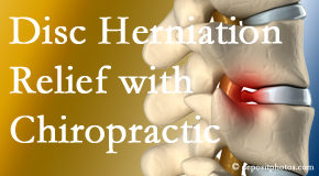 Chiropractic Spine Sports And Rehabilitation gently treats the disc herniation causing back pain. 